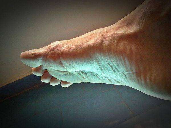 Trening stóp - jakie ćwiczenia warto wykonywać między wizytami u podologa?