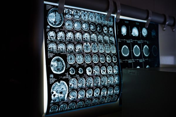 Technologie przyszłości: Jak elektronika i informatyka zmieniają medycynę?